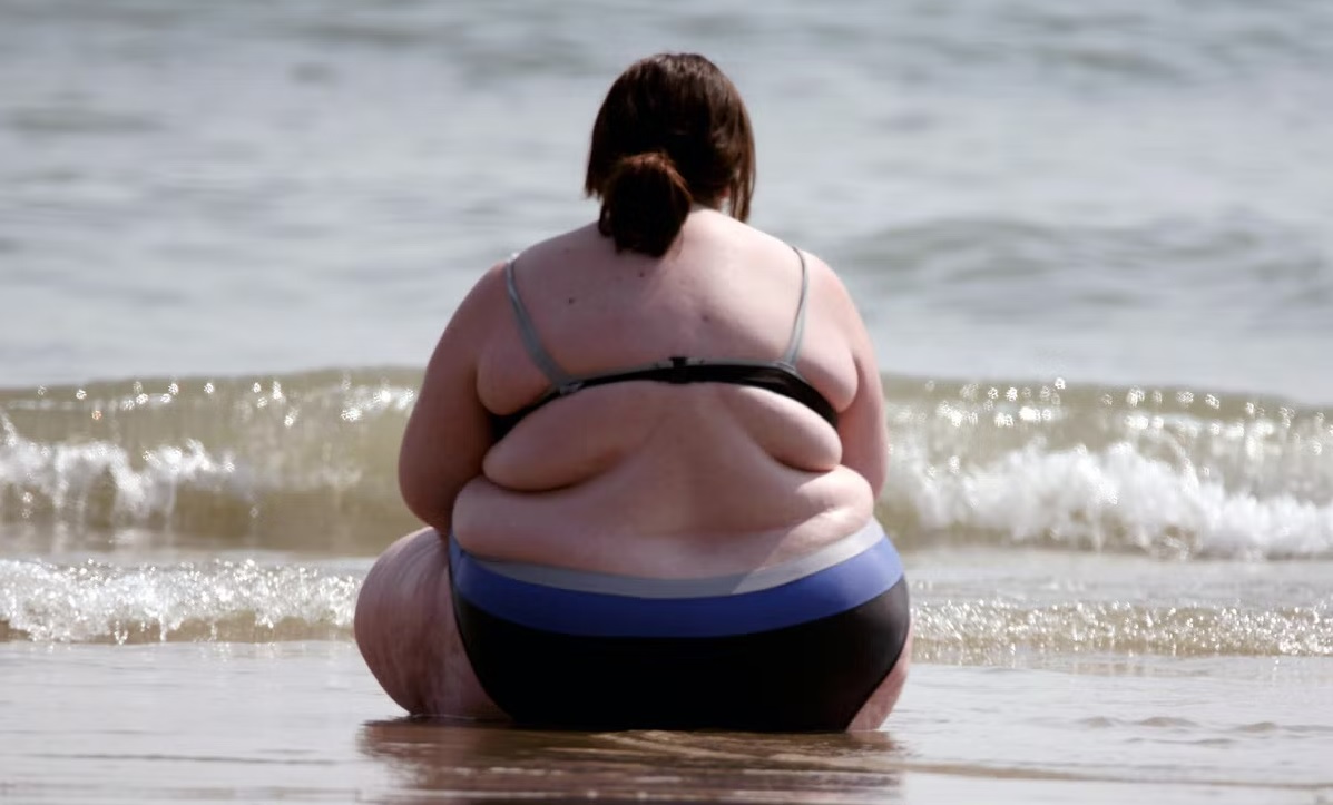 C'è una terapia salvavita per i grandi obesi?